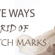 effective ways to get rid of stretch marks