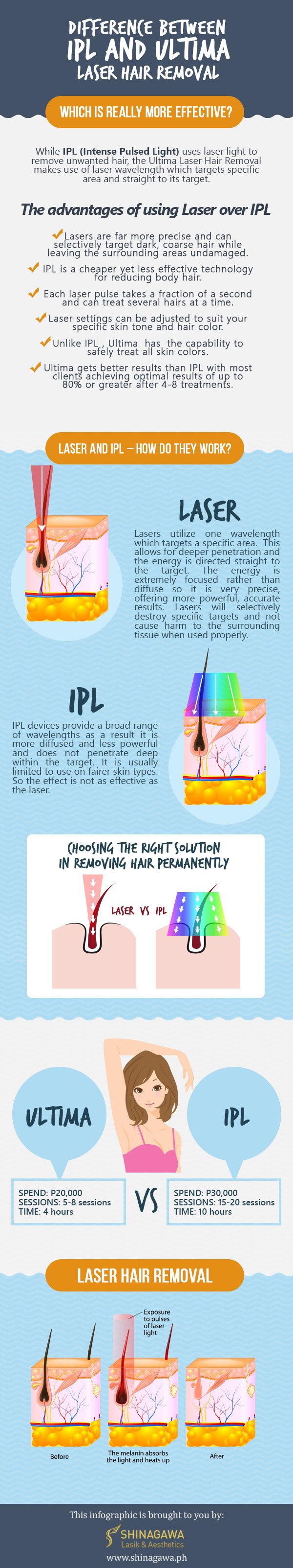 DIFFERENCE BETWEEN IPL AND ULTIMA LASER HAIR REMOVAL SHINAGAWA PH