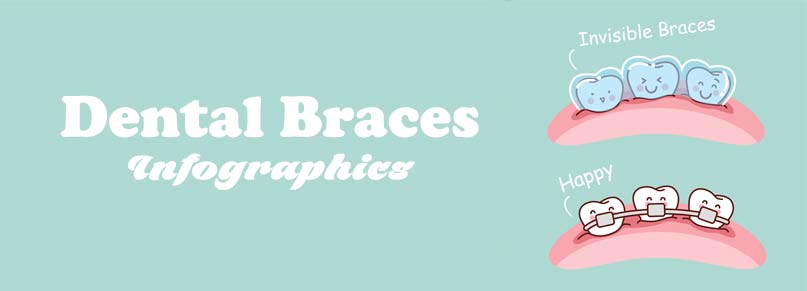 dental-braces-infographics-shinagawa.ph