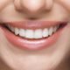 Maintaning Teeth After Whitening Treatment Blog Photo