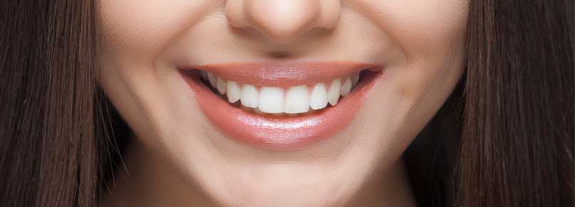 Maintaning Teeth After Whitening Treatment Blog Photo