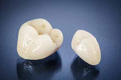 All-ceramic Teeth