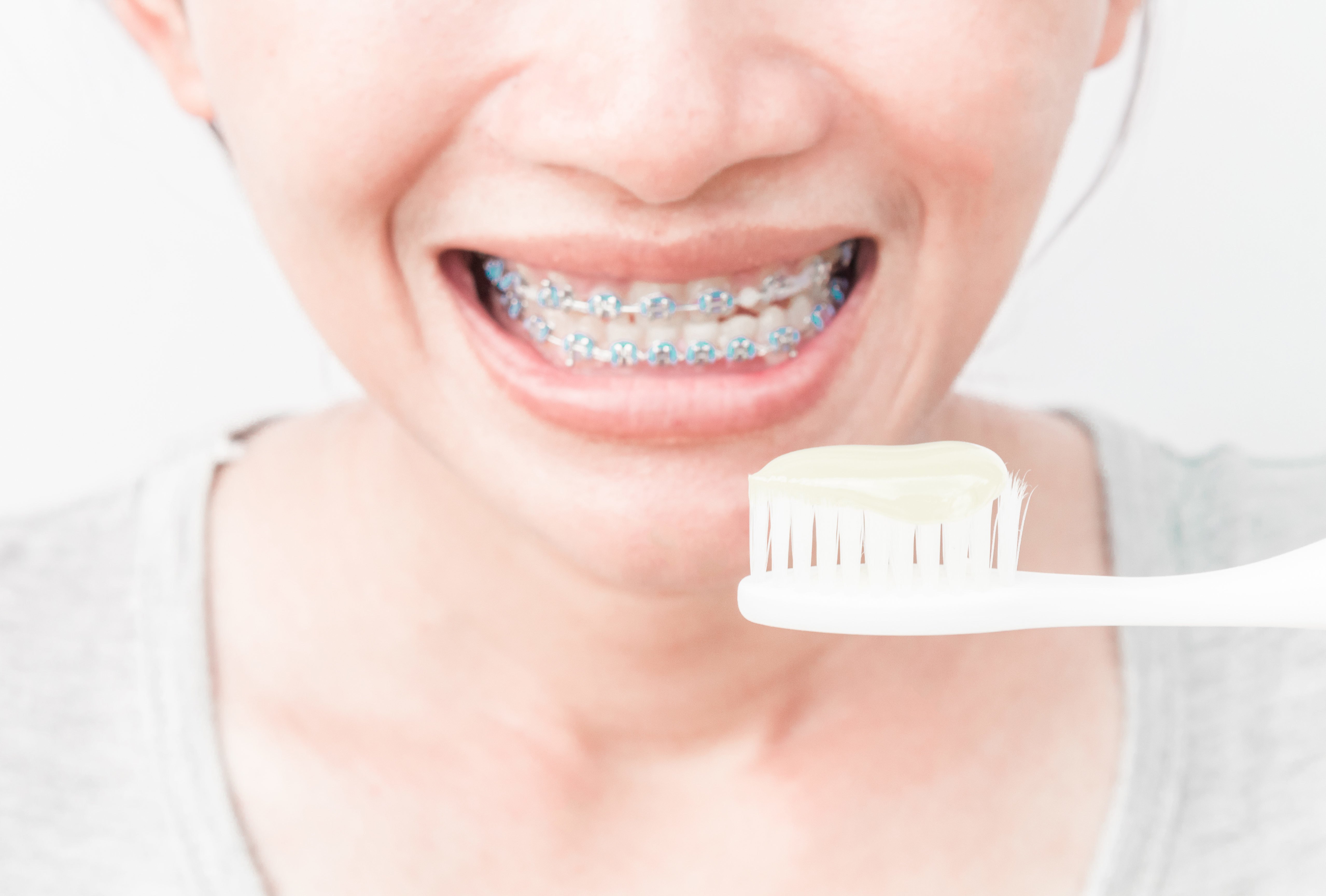 Proper Care for Your Braces