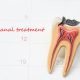 Save Your Tooth through Root Canal Treatment
