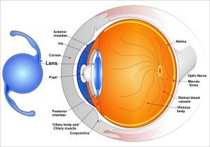 What Are The Differences Of IOLs In Cataract Surgery?
