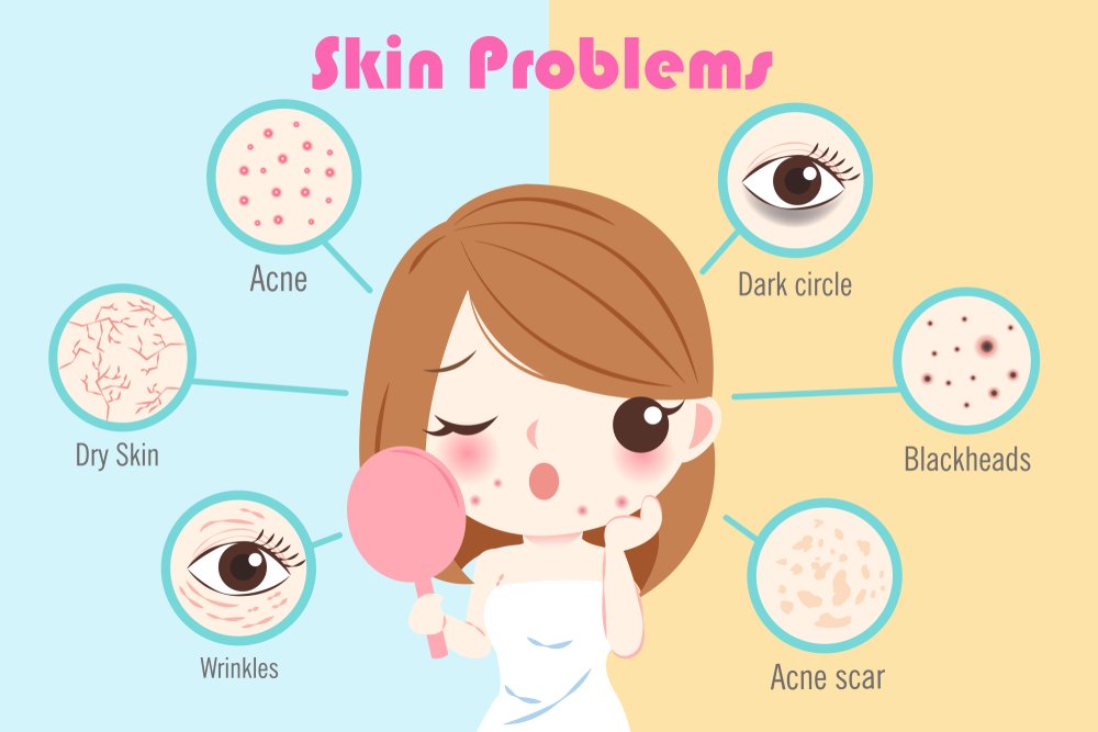 Knowing Your Skin Problems