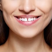 Causes of Gapped Teeth 1