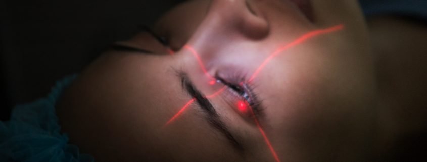 Actress/Beauty Queen Megan Young calmly undergo the laser part of her procedure with her eyes wide open.