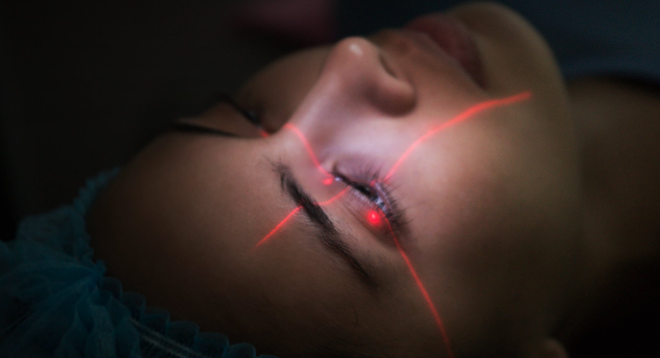 Actress/Beauty Queen Megan Young calmly undergo the laser part of her procedure with her eyes wide open.