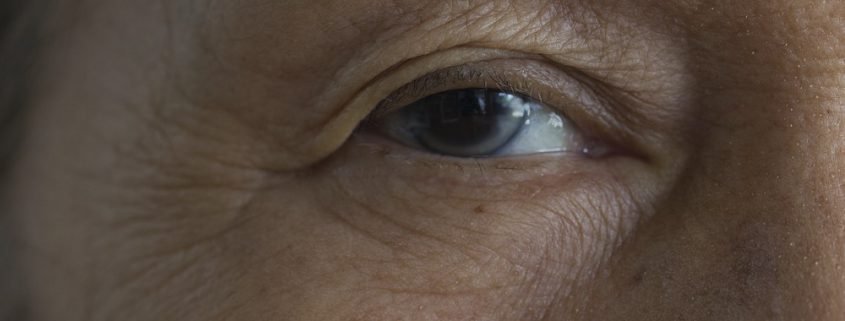 Does a Cataract Need to be Fully Ripe for it to be Removed?