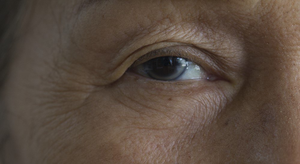 Does a Cataract Need to be Fully Ripe for it to be Removed?