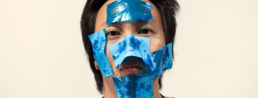 Common Causes Of Oily Skin | Shinagawa Aesthetics Blog