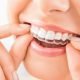 Invisalign The Modern Method Of Teeth Aligning 1 | Shinagawa Dental Blog
