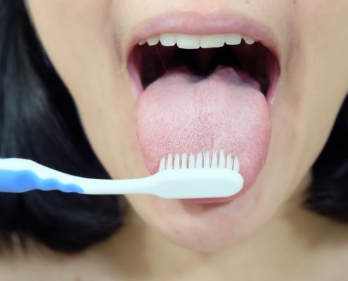 The Importance Of Cleaning Your Tongue 2 | Shinagawa Orthodontics Blog