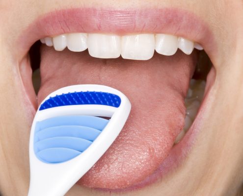 The Importance Of Cleaning Your Tongue 3 | Shinagawa Orthodontics Blog