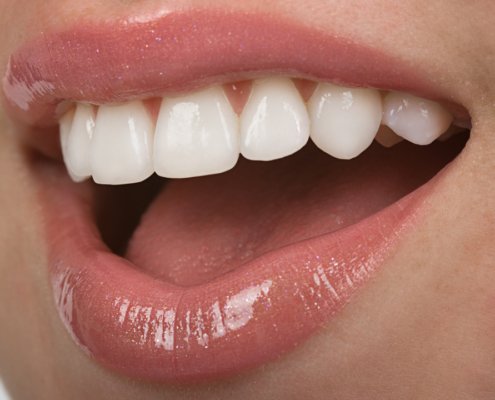 Straight Teeth | Shinagawa Dental Blog