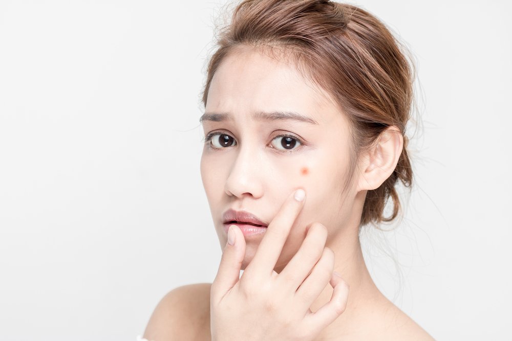 The Difference Between Dry And Oily Acne | Shinagawa Aesthetics Blog