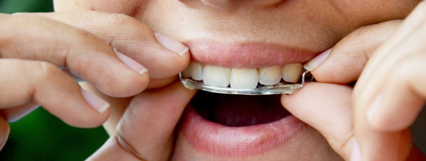 Ways To Get The Most Out Of Your Dental Treatment | Shinagawa Dental Blog