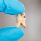 How To Effectively Prevent Tooth Decay | Shinagawa Dental Blog