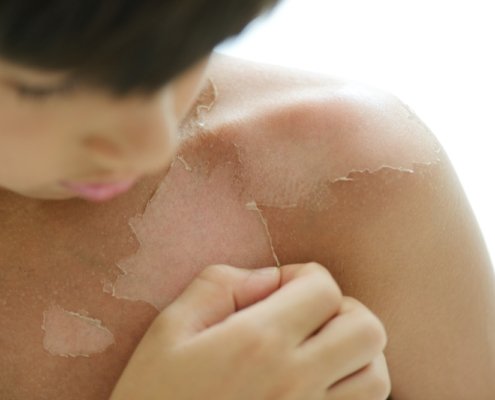 Skin Damage Causes | Shinagawa Aesthetics Blog