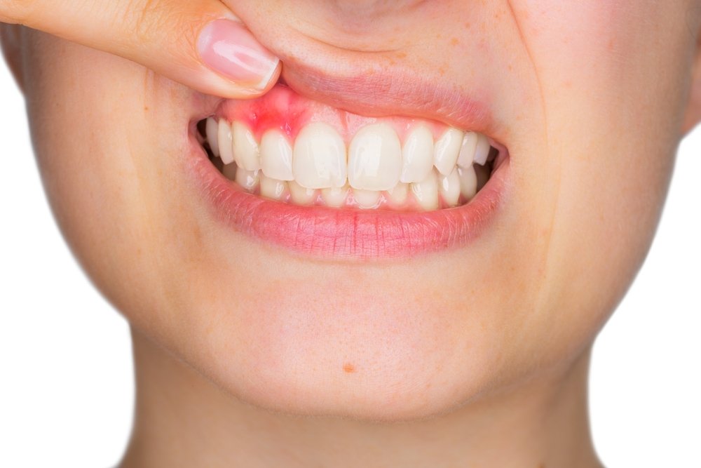 Knowing Gum Disease Better | Shinagawa Dental Blog