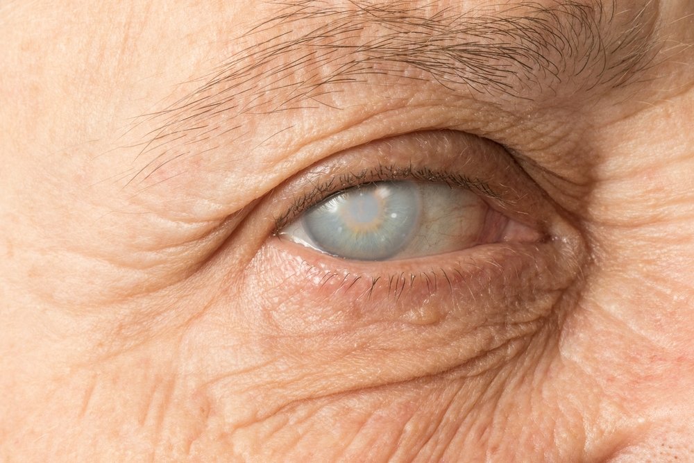 Problems Faced By People With Cataract | Shinagawa Cataract Blog