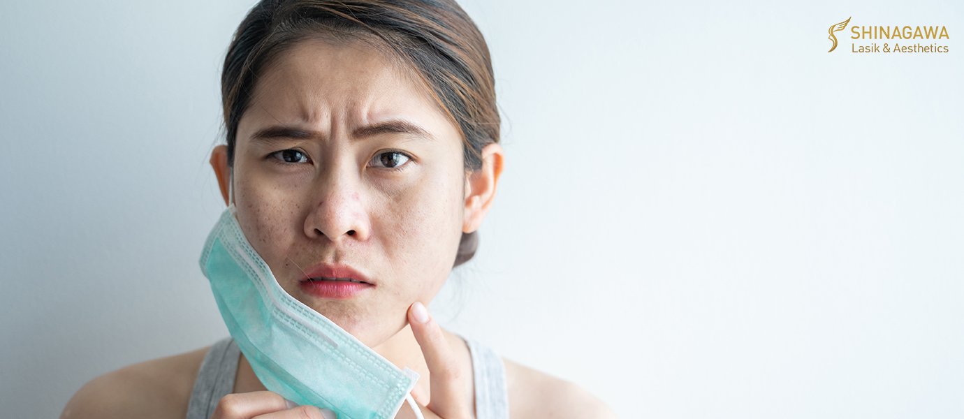 What Led To Your 'Quarantine Skin'? | Shinagawa Blog