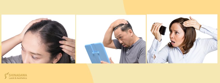 Home Remedies To Fight Hair Thinning | Shinagawa Blog