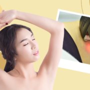 Maximum Smoothness With Laser Hair Removal | Shinagawa Blog