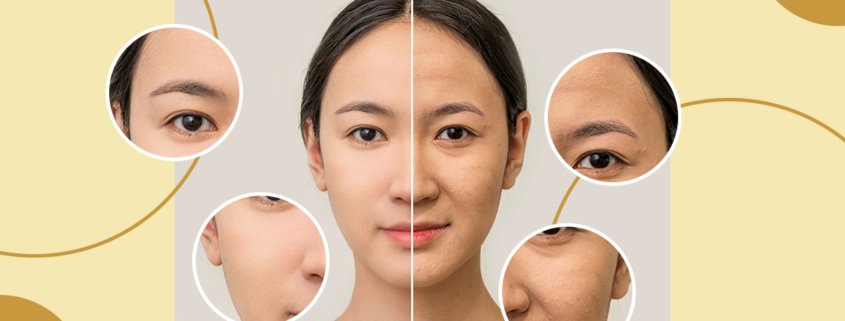 Difference Between Dermal Fillers And Beauty-Tox | Shinagawa Blog