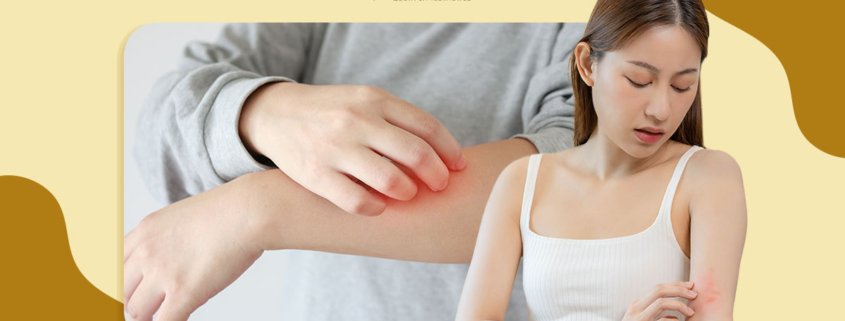 When Does Itchy Skin Become A Serious Problem? | Shinagawa Blog