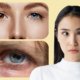 Knowing Rare And Bizarre Eye Conditions | Shinagawa Blog