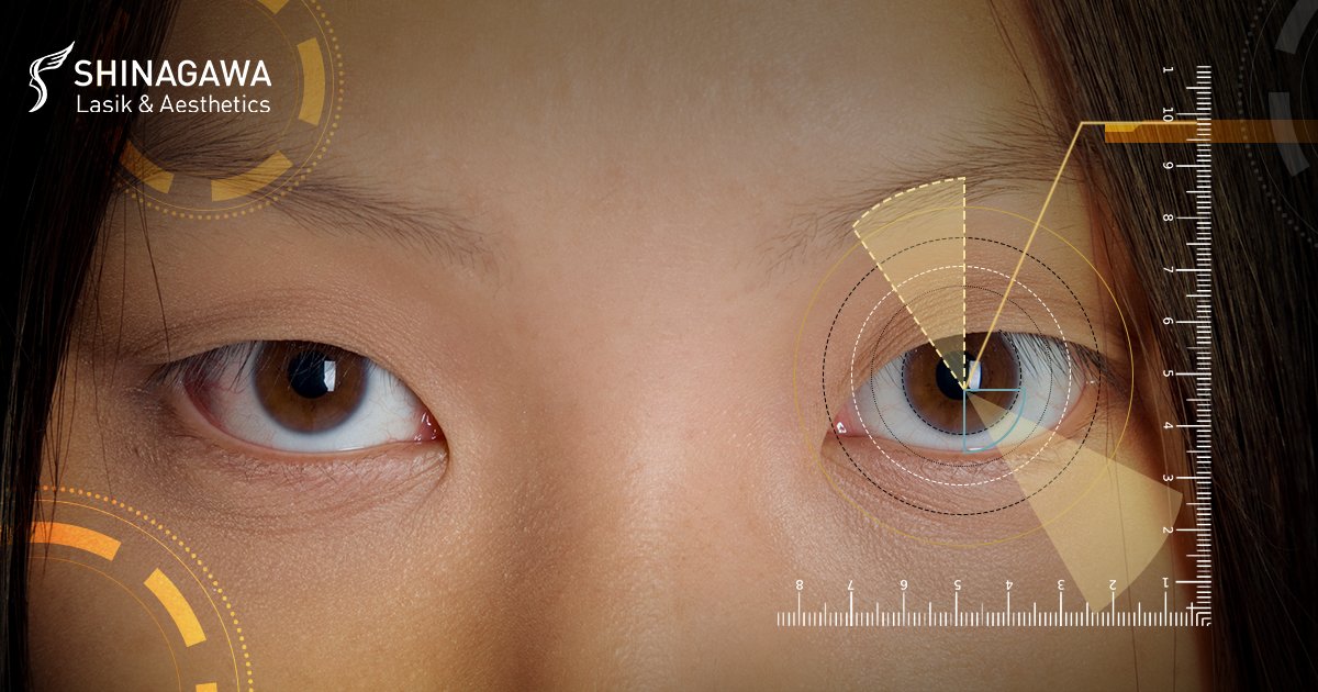does eye shape affect vision