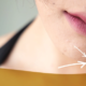 Reasons to See a Dermatologist for Mole Removal
