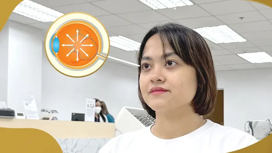 Woman undergoing eye pressure evaluation for glaucoma screening at Shinagawa Lasik & Aesthetics.