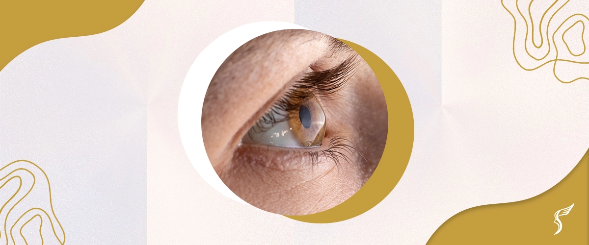 What is the Perfect Vision?