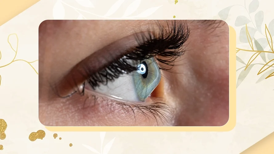 Better Understanding of Keratoconus