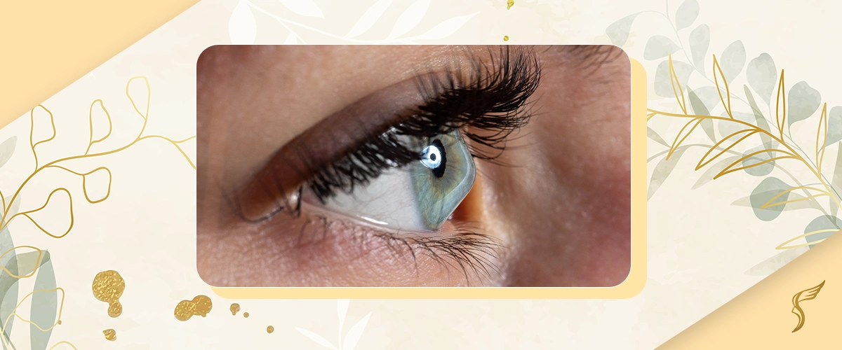 Better Understanding of Keratoconus