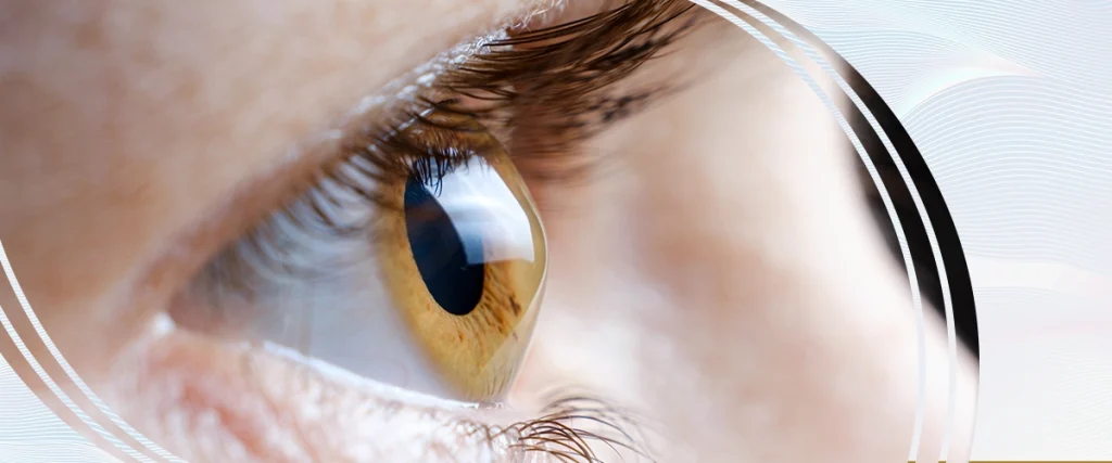 Non-Surgical Ways to Correct Astigmatism
