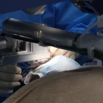 Close-up of a LASIK eye surgery procedure at Shinagawa Lasik & Aesthetics using advanced laser technology and medical instruments