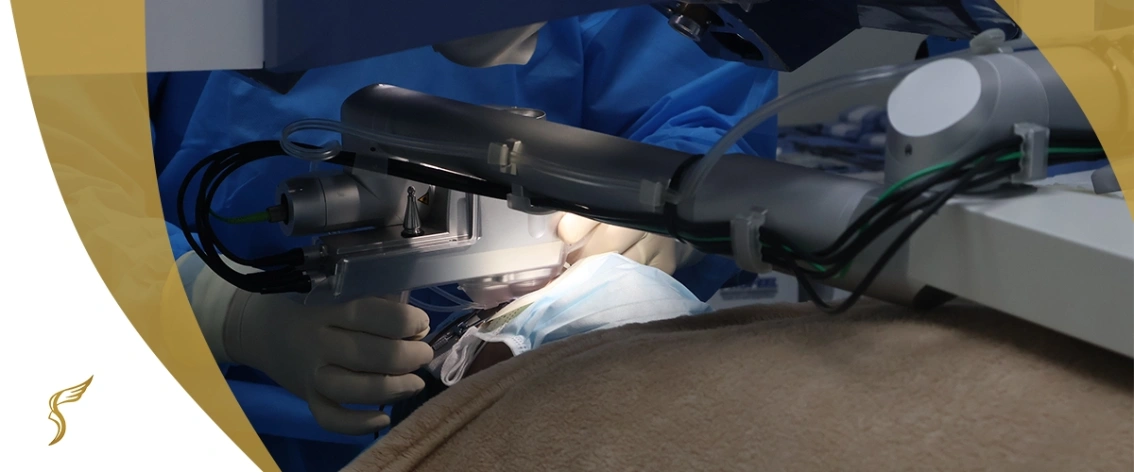 Close-up of a LASIK eye surgery procedure at Shinagawa Lasik & Aesthetics using advanced laser technology and medical instruments