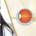 Patient undergoing eye checkup with slit lamp alongside medical illustration of corrected vision at Shinagawa Lasik & Aesthetics in the Philippines