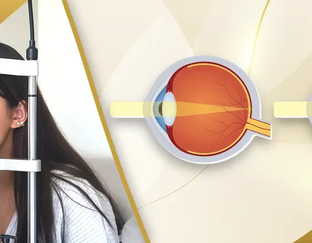 Patient undergoing eye checkup with slit lamp alongside medical illustration of corrected vision at Shinagawa Lasik & Aesthetics in the Philippines