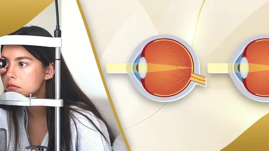 Patient undergoing eye checkup with slit lamp alongside medical illustration of corrected vision at Shinagawa Lasik & Aesthetics in the Philippines