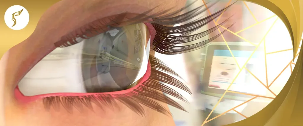 Close-up illustration of human eye with reflection of diagnostic equipment, highlighting advanced LASIK technology at Shinagawa Lasik & Aesthetics Philippines