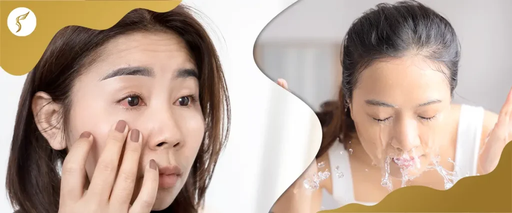 Woman with eye irritation touching her eyelid beside another woman washing her face, showing proper eye care and hygiene recommended by Shinagawa Lasik & Aesthetics.